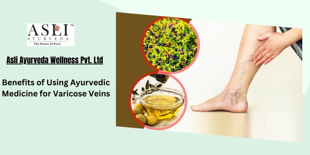 Benefits of Using Ayurvedic Medicine for Varicose Veins